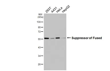 Anti-Suppressor of Fused antibody [HL3375] used in Western Blot (WB). GTX641195