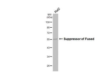 Anti-Suppressor of Fused antibody [HL3375] used in Western Blot (WB). GTX641195