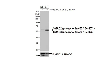 Anti-SMAD2 (phospho Ser465 / Ser467)  +  SMAD3 (phospho Ser423 / Ser425) antibody [HL3379] used in Western Blot (WB). GTX641199