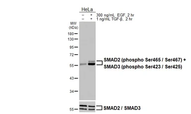 Anti-SMAD2 (phospho Ser465 / Ser467)  +  SMAD3 (phospho Ser423 / Ser425) antibody [HL3379] used in Western Blot (WB). GTX641199