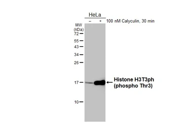 Anti-Histone H3T3ph (phospho Thr3) antibody [HL3381] used in Western Blot (WB). GTX641201