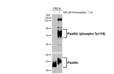 Anti-Paxillin (phospho Tyr118) antibody [HL3384] used in Western Blot (WB). GTX641204
