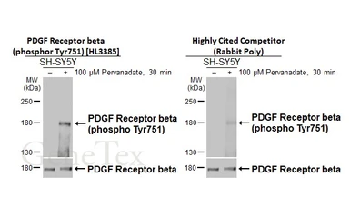 Anti-PDGF Receptor beta (phospho Tyr751) antibody [HL3385] used in Western Blot (WB). GTX641205