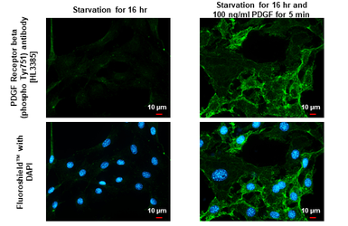 Anti-PDGF Receptor beta (phospho Tyr751) antibody [HL3385] used in Immunocytochemistry/ Immunofluorescence (ICC/IF). GTX641205