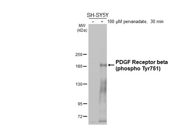 Anti-PDGF Receptor beta (phospho Tyr751) antibody [HL3385] used in Western Blot (WB). GTX641205