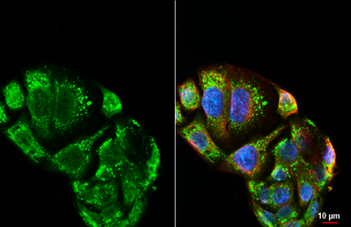 Anti-FGFR3 antibody [HL3389] used in Immunocytochemistry/ Immunofluorescence (ICC/IF). GTX641209