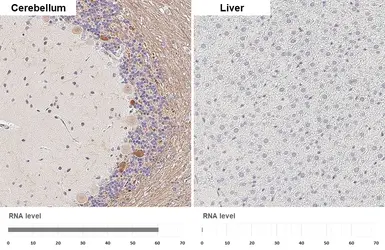 Anti-PGP9.5 antibody [HL3390] used in IHC (Paraffin sections) (IHC-P). GTX641210
