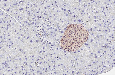 Anti-PGP9.5 antibody [HL3391] used in IHC (Paraffin sections) (IHC-P). GTX641211