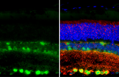 Anti-PGP9.5 antibody [HL3391] used in IHC (Paraffin sections) (IHC-P). GTX641211