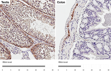 Anti-PGP9.5 antibody [HL3391] used in IHC (Paraffin sections) (IHC-P). GTX641211