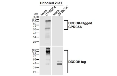 Anti-GPRC5A antibody [HL3393] used in Western Blot (WB). GTX641213