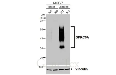 Anti-GPRC5A antibody [HL3393] used in Western Blot (WB). GTX641213