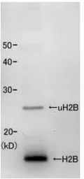 Anti-Histone H2B (S. pombe) antibody used in Western Blot (WB). GTX64122