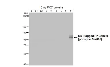 Anti-PKC theta (phospho Ser695) antibody [HL3396] used in Western Blot (WB). GTX641233
