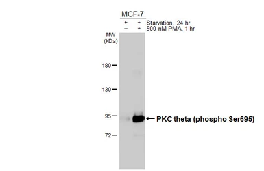 Anti-PKC theta (phospho Ser695) antibody [HL3397] used in Western Blot (WB). GTX641234