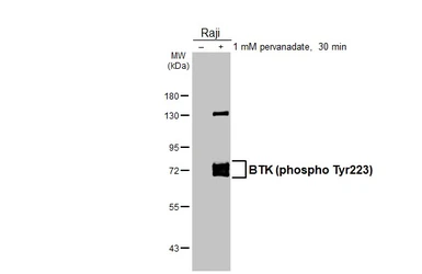 Anti-BTK (phospho Tyr223) antibody [HL3403] used in Western Blot (WB). GTX641240