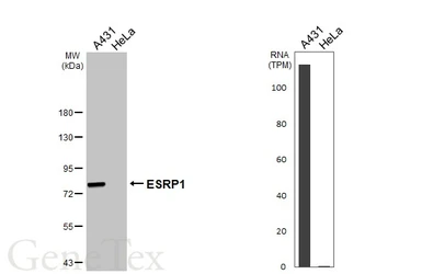 Anti-ESRP1 antibody [HL3413] used in Western Blot (WB). GTX641250