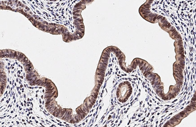 Anti-ESRP1 antibody [HL3413] used in IHC (Paraffin sections) (IHC-P). GTX641250