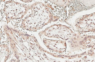 Anti-Rad21 antibody [HL3416] used in IHC (Paraffin sections) (IHC-P). GTX641258