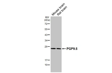 Anti-PGP9.5 antibody [HL3417] used in Western Blot (WB). GTX641259