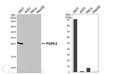 Anti-PGP9.5 antibody [HL3417] used in Western Blot (WB). GTX641259