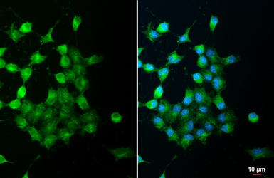 Anti-DLK/MAP3K12 antibody [HL3423] used in Immunocytochemistry/ Immunofluorescence (ICC/IF). GTX641265