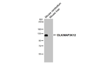 Anti-DLK/MAP3K12 antibody [HL3423] used in Western Blot (WB). GTX641265
