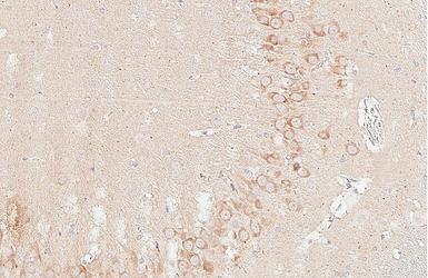 Anti-DLK/MAP3K12 antibody [HL3423] used in IHC (Paraffin sections) (IHC-P). GTX641265