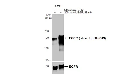 Anti-EGFR (phospho Thr669) antibody [HL3425] used in Western Blot (WB). GTX641267