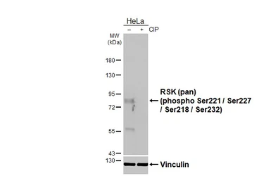 Anti-RSK (pan) (phospho Ser221 / Ser227 / Ser218 / Ser232) antibody [HL3427] used in Western Blot (WB). GTX641269