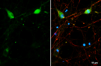Anti-mGluR5 antibody [HL3433] used in Immunocytochemistry/ Immunofluorescence (ICC/IF). GTX641275