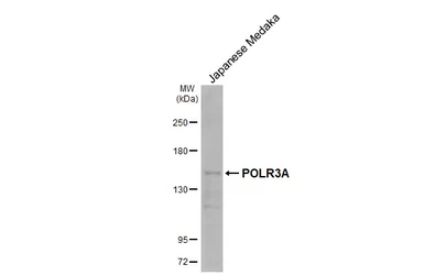 Anti-POLR3A antibody [HL3437] used in Western Blot (WB). GTX641310