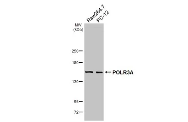 Anti-POLR3A antibody [HL3437] used in Western Blot (WB). GTX641310