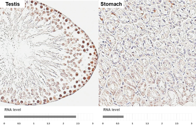 Anti-POLR3A antibody [HL3437] used in IHC (Paraffin sections) (IHC-P). GTX641310