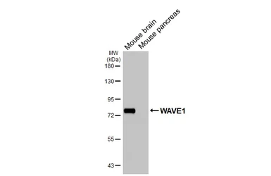 Anti-WAVE1 antibody [HL3445] used in Western Blot (WB). GTX641318