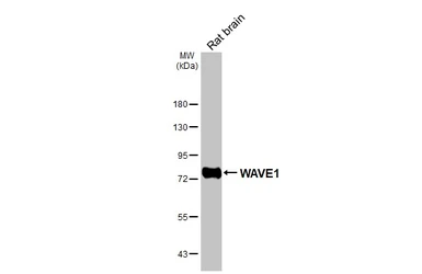 Anti-WAVE1 antibody [HL3445] used in Western Blot (WB). GTX641318