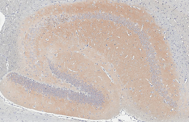Anti-WAVE1 antibody [HL3445] used in IHC (Paraffin sections) (IHC-P). GTX641318