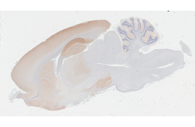 Anti-WAVE1 antibody [HL3445] used in IHC (Paraffin sections) (IHC-P). GTX641318