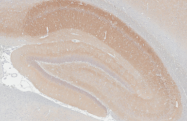 Anti-WAVE1 antibody [HL3445] used in IHC (Paraffin sections) (IHC-P). GTX641318