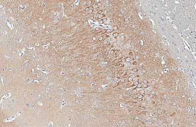 Anti-WAVE1 antibody [HL3445] used in IHC (Paraffin sections) (IHC-P). GTX641318