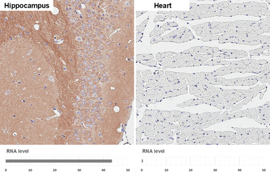 Anti-WAVE1 antibody [HL3445] used in IHC (Paraffin sections) (IHC-P). GTX641318