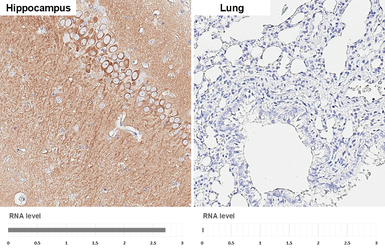 Anti-WAVE1 antibody [HL3445] used in IHC (Paraffin sections) (IHC-P). GTX641318