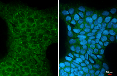 Anti-MROH2A antibody [HL3448] used in Immunocytochemistry/ Immunofluorescence (ICC/IF). GTX641321