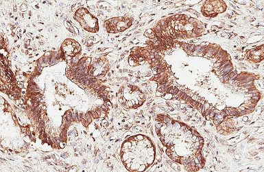 Anti-MROH2A antibody [HL3448] used in IHC (Paraffin sections) (IHC-P). GTX641321