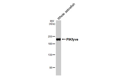 Anti-PIKfyve antibody [HL3449] used in Western Blot (WB). GTX641322