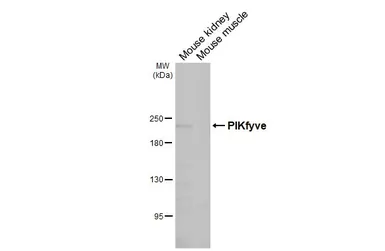 Anti-PIKfyve antibody [HL3449] used in Western Blot (WB). GTX641322
