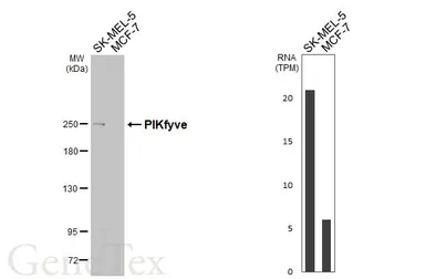 Anti-PIKfyve antibody [HL3449] used in Western Blot (WB). GTX641322