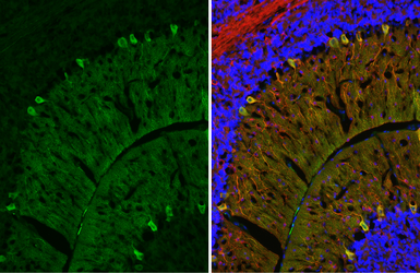 Anti-LRRK2 antibody [GT48] used in IHC (Frozen sections) (IHC-Fr). GTX641333