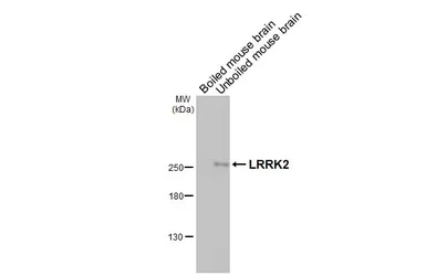Anti-LRRK2 antibody [GT48] used in Western Blot (WB). GTX641333