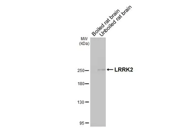 Anti-LRRK2 antibody [GT48] used in Western Blot (WB). GTX641333